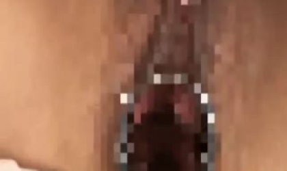 娇美可爱的美女被绑在术台上